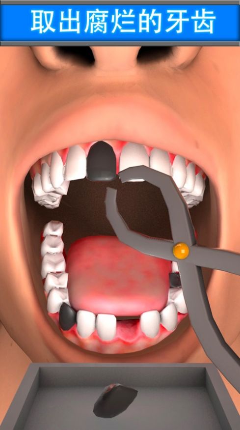 虚拟牙医牙齿童话游戏图2
